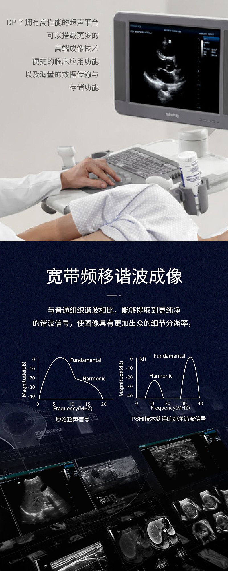 迈瑞医疗获得发明专利授权:“血管壁剪切指数显示方法及超声成像系统”
