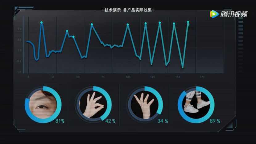 新型AI模型可通过血检识别多种神经退行性疾病