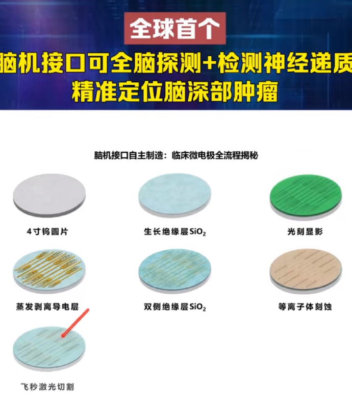 脑机接口是高门槛技术，落地仍需临床验证和医工结合
